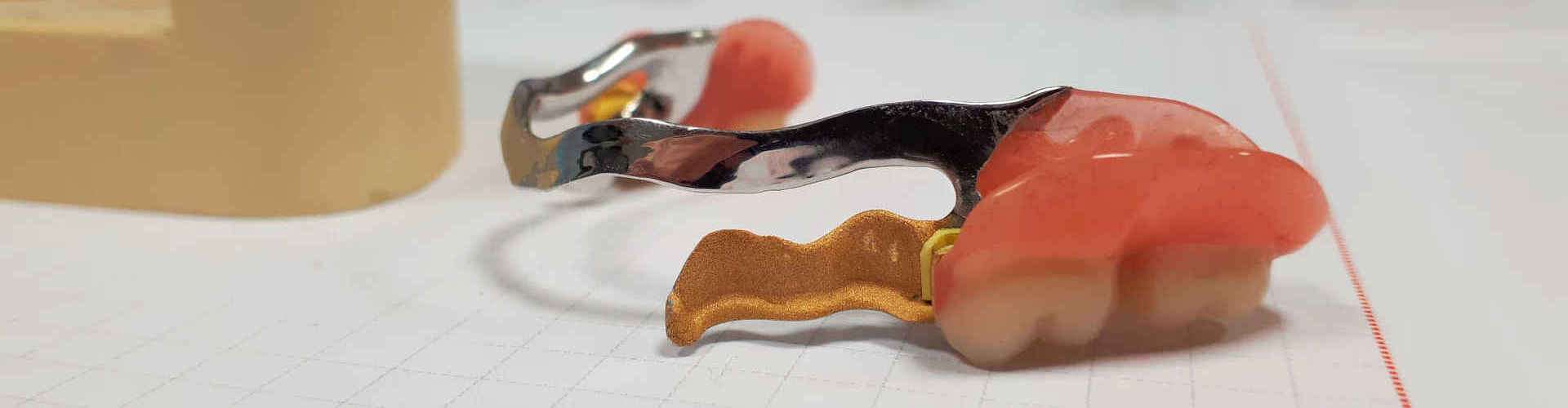 Dentallabor für ästhetische Zahntechnik – ScalaDent Berlin