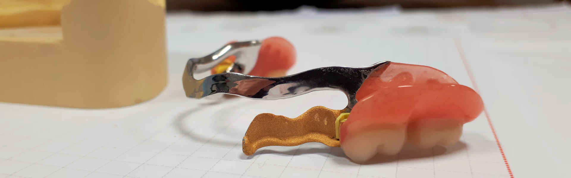 Dentallabor für ästhetische Zahntechnik – ScalaDent Berlin